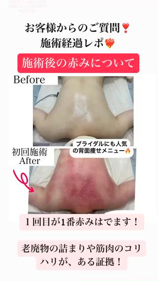 背中痩せ★ブライダルにオススメ→
温熱パワーとEMSの筋肉運動で
血行促進、老廃物をデトックス！ 