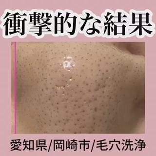 毛穴の黒ずみ消えます
驚きのツルツル肌になってみませんか 