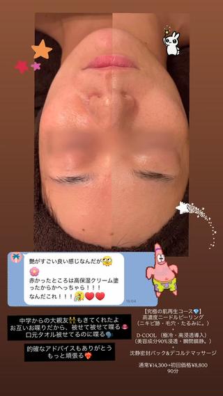 lucia  豊明 肌管理のエステ・リラクイメージ