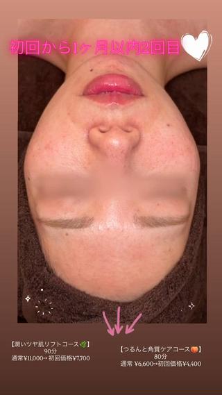 lucia  豊明 肌管理のエステ・リラクイメージ