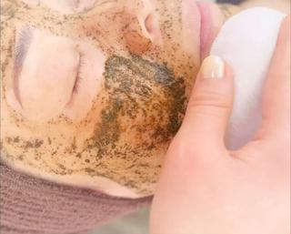 ハーブピーリング(REVI陶肌トリートメント)施術風景です 