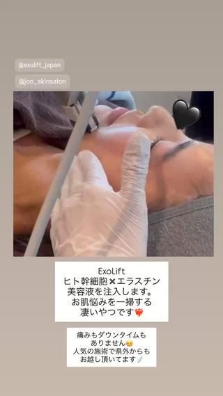 Joo🌿ナツキ 肌育/エイジングのその他イメージ