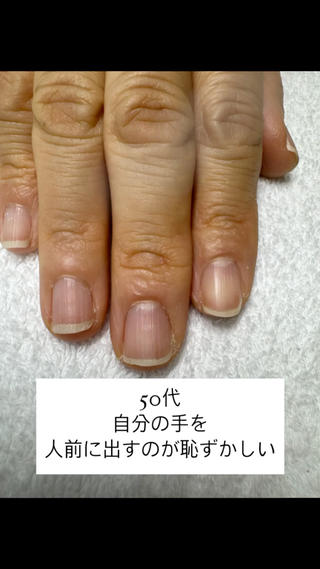 “自信のない手”から“自信のある手”になるには
1ヶ月〜3ヶ月。
爪はダイエットよりもラクに変われます♡ 