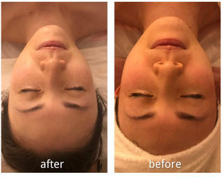 肩こり、首こりを改善しながら顔のツボ押し,リンパ流し,タッピングでお顔のむくみ＆透明肌＆美肌効果が期待できます。使用する美容液を保湿or肌色upからお選びいただけます☆（フェイシャル/小顔/毛穴/ヘットスパ)　 