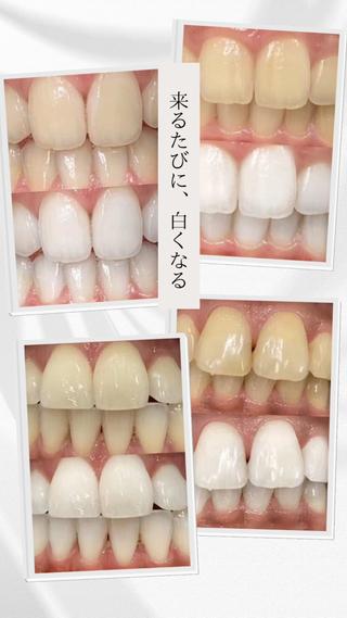 歯科提携セルフダック 宇都宮駒生店のエステ・リラクイメージ