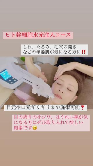 しわ、たるみ、くすみ、毛穴の開きなどが気になる年齢肌に
ヒト幹細胞水光注入コース
高速ジェットエアーの力でヒト幹細胞培養液を肌の奥に届けます。
目元口元ギリギリまで施術できるので、目の周りの小ジワやほうれい線が気になる方におすすめ
ベラージュのフェイシャルは、お仕上げにこだわりあり
美肌&美髪育成仕上げ