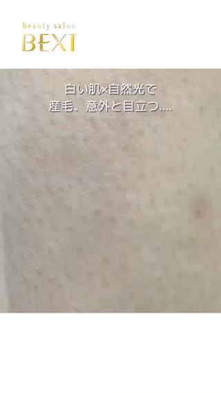#名古屋脱毛#産毛脱毛#メンズ脱毛#レディース脱毛#全身脱毛#足脱毛#背中脱毛#ワキ脱毛#顔脱毛