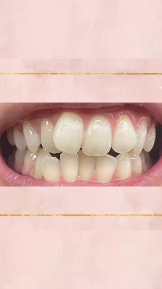#セルフホワイトニング#セルフホワイトニング名古屋#セルフホワイトニング名駅#ホワイトニング名古屋#ホワイトニング名駅#ホワイトニングサロン#名古屋美容サロン#レディースホワイトニング#メンズホワイトニング