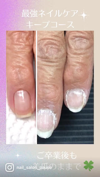 ネイル プライベートネイルサロンPause(ポーズ)所属・自爪育成ネイルサロン Pause(ポーズ)のネイルデザイン