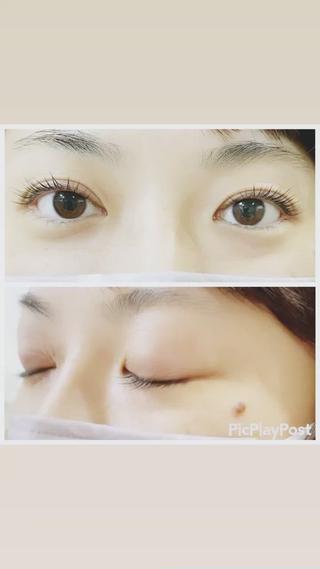 パリジェンヌラッシュリフト瞼にたるみが少なく、くっきり二重の人にオススメです︎