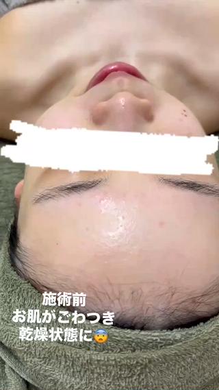 陶肌トリートメント 