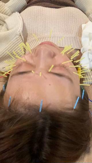 美容鍼サロンAcutyアキュティ吉祥寺所属・橋爪 弘樹のその他イメージ