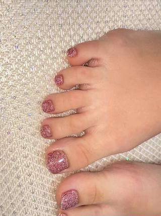 フラッシュラメ 