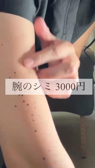 【夏の終わりに、腕のシミ対策を】

腕のシミ、気になっていませんか？
夏が終わるこのタイミングで、IPL照射をおすすめします。

一般的には「フォトRF」や「Eライトフォト」として知られている施術です。

腕はターンオーバーが遅く、
シミがたんぱく質として排出されるまで時間はかかりますが、
何もしないより断然マシです。
はがれてきても自分で剥かないでね。

︎価格：1回 3,000円（破格）
顔の照射も同価格で対応可能です（※顔は少し痛みがあります）
•ノーメイクでご来店ください
•日焼け止めは必須です
•破格で提供しておりますので、みなさまのご協力に感謝いたします！
 