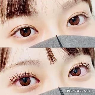 +550円でケラチンブースト可能
まつ毛の90%ケラチンで構成されていると言われています。
ラッシュリフトはセッティング剤により科学的に毛の内部を変化させるため、ケラチンを表面に塗ることによりダメージから髪を守ることができ、
まつ毛の質の修復改善に繋がります。
瞼のリフトアップ効果
逆まつ毛の矯正効果
下がりまつ毛が気になる方
グルーアレルギーでまつエクを付けれない方
自まつ毛派の方
ビューラーが苦手な方
・80°立ち上げる為、瞼のリフトUP抜群!
・カールを付けないので自まつ毛を最大限に長く魅せます
・影を無くし、白目に光が入る事でブライト効果があり、目が輝いて見えます
・持続性4~6週間
・自まつ毛が傷みにくい
《 不向きな方 》
・自まつ毛に部分的に生えていない箇所がある
・瞼が厚く生え際が埋まってしまっている
パーマ液はまつげ用は大きく分けて下の2種類です。
チオ系(医薬部外品登録)
シスアミ系(化粧品登録)
それぞれの特徴は、チオ系は感作製が少なく安定しておりハリコシがあるカールを作ることができます。シスアミ系はタンパク質を破壊しにくく、一般的に低ダメージと言われています。
そしてこの2つの還元剤の大きな違いと言えるのがそれぞれの登録カテゴリーです。医薬部外品登録と化粧品登録となっていますね。
パリジェンヌラッシュリフトはシスアミ系なので自まつげに負担が少なく優しい薬剤です。
その為2度付けしてしっかりカールを作っていきます。
初めての方やハリコシがありかかりにくい方は1ヶ月以内に再度かけることによりよりしっかり立ち上げることができます。
こんな方はかかりにくいです
どれだけしっかりロッドに巻き付け、薬剤を長く浸けたとしても、どうしてもかかりにくい方がいます。それどころか長く置くほどまつげを痛めてしまう原因になってしまいます。
長く置けばかかると思いがちですが毛質、生活習慣、体調、ホルモンバランスにより、どうしてもかかりにくい方がいらっしゃいます。
その理由としては以下の点です。
◆太くてハリのあるまつげ
キューティクルがしっかりしている健康なまつげはパーマ液が浸透しにくくなるため。
◆細いまつげ
パーマの液剤が浸透しにくい
◆柔らかいまつげ
固定する力が弱く、パーマが持続しにくい
◆ホルモンバランスの乱れ
生理中や生理不順、出産直後など
◆タンパク質の減少
年齢によりタンパク質が減少している。
痛みすぎて毛の芯がない。
タンパク質が流れ出ていっている。
もしくは壊されてる。etc...
体調不良
風邪をひいていた。
もしくは風邪が長引いている。
薬を飲んでいる
飲んでいるお薬の成分によりますが何らかの成分により毛質に影響をうけている
目をゴシゴシかいている、ビューラーを使っている
これらの方はタンパク質が減少している恐れがあります。
どうしてもかかりにくい方は再度かけ直す必要があります。
#名古屋マツエク#名古屋マツエクサロン#名古屋まつ毛エクステ#名古屋まつげエクステ#名古屋マツゲエクステ#名古屋アイラッシュ#名古屋アイラッシュサロン#名古屋マツゲパーマ#名古屋まつ毛パーマ#マツパー#パリジェンヌ#パリジェンヌラッシュリフト#名古屋パリジェンヌ#名古屋パリジェンヌラッシュリフト#根元から立ち上げパーマ#ラッシュリフト#Lカール#Cカール#マツゲパーマキュートデザイン#HBL#眉毛パーマ#まゆ毛パーマ#まゆげパーマ#マユゲパーマ#ハリウッドブロウリフト#名古屋ハリウッド#名古屋ハリウッドブロウリフト#ブロウラミネーション#ブロウラミネート#フラットマット#フラットマットラッシュ#ボリュームラッシュ#フェザーラッシュ#バインドロック#バインドフラット#Wフラット#2Dフラット#ラッシュアディクト#マツ育#マユ育#まゆ育#まつ育#名古屋ラッシュアディクト#フェイシャルソニック#名古屋ソニック#名古屋フェイシャル超音波#ケラチンブースト#アイシャンプー#低刺激グルー#ブチルグルー#ヘッドスパ#エグータム#マツゲ美容液#まつげ美容液#spicare#vos#イノスピキュール#v3ファンデーション#眉毛