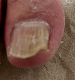 #フットケア
#フットトラブル
#フットネイル
#フットジェル
#巻き爪
#爪のトラブル 
#爪のコンプレックス
#ベテランネイリスト
#爪の専門家 