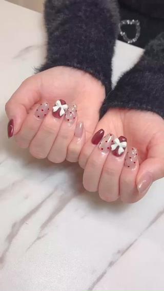 定額スタンダードコース 