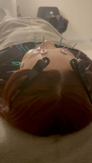 美容鍼はヘッドスパもつきます！ 