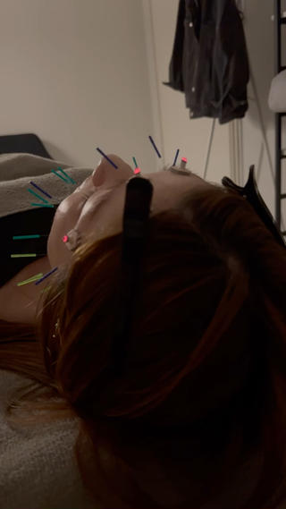 美容鍼×小顔矯正 ×美容整体　浜川泰仁のエステ・リラクイメージ