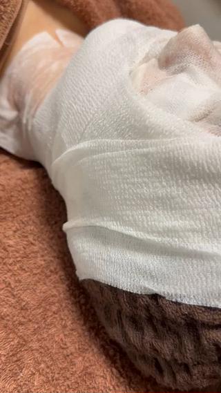 Carboxy therapy
痛気持ちいいが病みつきになる

◉毛穴の開き、黒ずみ
◉ニキビ痕
◉赤み
◉乾燥
◉浮腫改善
◉ほうれい線、シワ
◉くすみ

お悩みの方、オススメです

《バンテージ》を使った【超小顔術】
でリフトアップ、たるみ、浮腫改善

また、
当サロンでは、
カーボキシー後は鎮静効果のある、
医療レベルのシカ成分配合のシートマスク、
#エピダームプラスマスク
も使用しております 