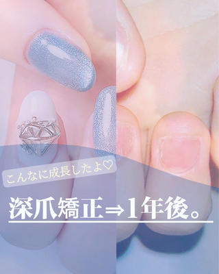 ネイル 爪咲 りり花のネイルデザイン