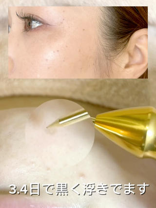 Instagram:@earth_esthetic 詳細はこちら 