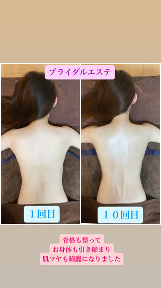 ブライダルエステで骨格姿勢矯正･筋膜オイルマッサージ･頭蓋骨小顔矯正を受けていただきました

骨格と背筋が整って、お身体が引き締まり、肌ツヤも綺麗になられました

姿勢矯正･美容整体と痩身エステを同時に受けられるプライベートサロンです

ブライダルエステをご検討中の方はチェックしてみてください

======================================



〒542-0086 
大阪市中央区西心斎橋2丁目10-13クリスタルエグゼ心斎橋501号室
Apple 心斎橋 近く
 
