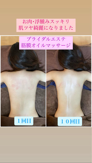 ブライダルエステで骨格姿勢矯正･筋膜オイルマッサージ･頭蓋骨小顔矯正を受けていただきました

姿勢･お身体のラインが綺麗になったのはもちろん
肌ツヤも綺麗になり、ご来店当初あった肩こり腰痛もスッキリしていただいたとご感想をいただきました

前撮りと挙式・披露宴に向けて、ブライダルエステを担当させていただき、ありがとうございました
おめでとうございます

姿勢矯正･美容整体と痩身エステを同時に受けられるプライベートサロンです

ブライダルエステをご検討中の方はチェックしてみてください


 
