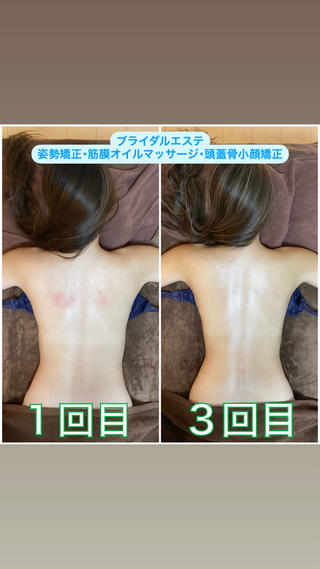 ブライダルエステ 美容整体・筋膜オイルのエステ・リラクイメージ