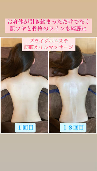 ブライダルエステで骨格姿勢矯正･筋膜オイルマッサージ･頭蓋骨小顔矯正を受けていただきました

背骨のＳ字ラインがとても綺麗になり、
ボディメイクと肌ツヤも良くなったので、挙式当日は化粧ノリが良くデコルテと背中のお肌も凄く綺麗になっていると思います

ブライダルエステを担当させていただき、ありがとうございました
これからもよろしくお願い致します

姿勢矯正･美容整体と痩身エステを同時に受けられるプライベートサロンです 