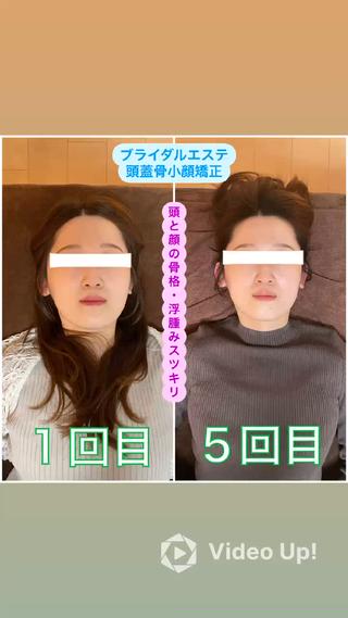 ブライダルエステ 美容整体・筋膜オイルのエステ・リラクイメージ