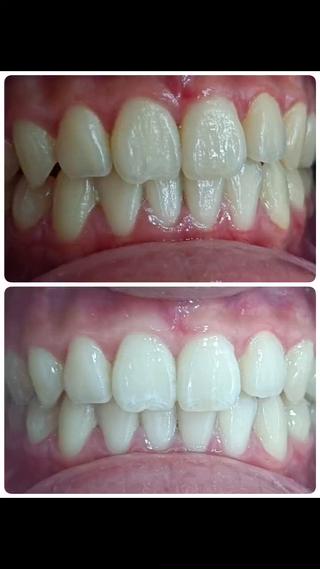 メンズ キッズ 美ろく　トータルビューティーサロン所属・セルフホワイトニング メーカー直営サロンのエステ・リラクイメージ