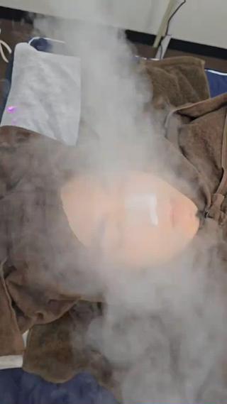 ハーブピーリング 