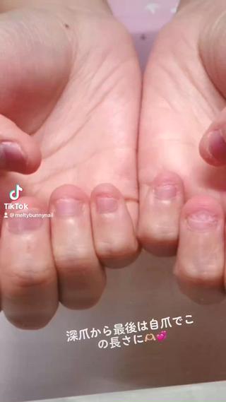 アート別料金です。こちらをされたい方はお問い合わせ下さい