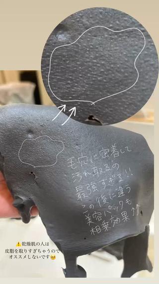 よーくみたら毛穴のカタチが見えるんです
白い艶っぽいのが皮脂汚れ


お肌のお掃除ができるとお化粧品の浸透も高まるので
暑い時期におすすめ♪ 