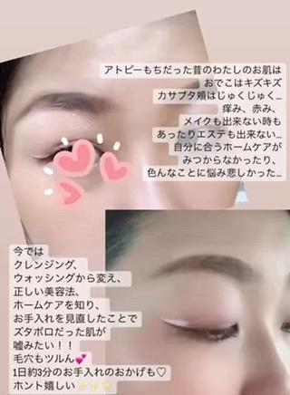 お家での正しいホームケア
美容法を優しくお伝えもしております。
お手入れを変えることにより、お肌が変わり
周りの方々からお肌の変化に気付いてもらえたり、
お肌が変わったことで、気持ちも上がるなど
嬉しいお言葉を沢山いただきます。
当サロンは10代〜70代
多くのお客様が通われております
ご予約もきちんと枠をおとりしますので、
ほかのお客様と被らずに安心してご来店頂けます