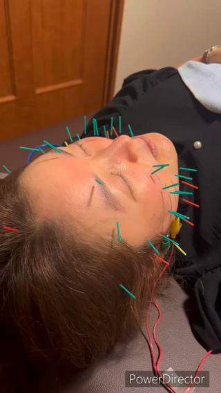 基本美容鍼パルス有
細かい刺激、ゆったりとした刺激
お求めに対してパルスの種類を選びます 