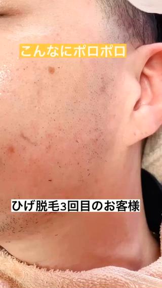 LUMINAルミナ 【肌管理サロン】のその他イメージ