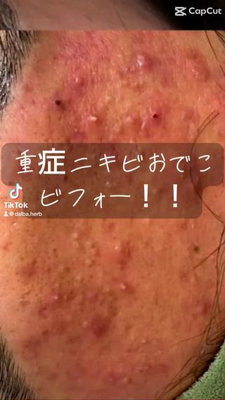 毛穴改善サロン d'Alba大阪住吉のエステ・リラクイメージ