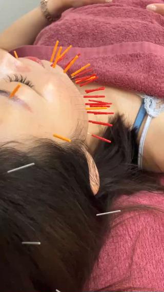 美容鍼灸女性専用 りんご鍼灸治療院のその他イメージ