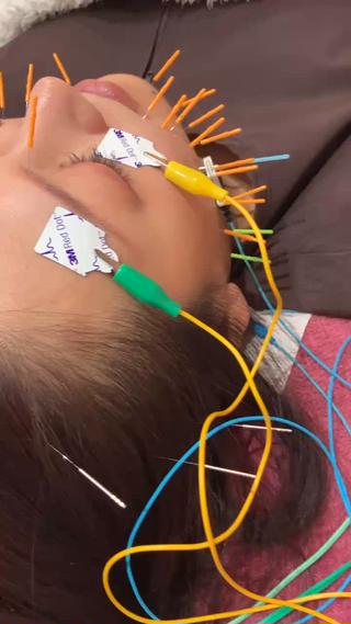 美容鍼灸女性専用 りんご鍼灸治療院のその他イメージ