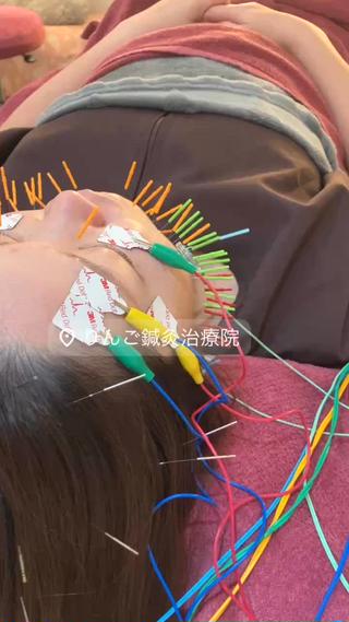 美容鍼灸女性専用 りんご鍼灸治療院のその他イメージ