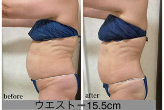 全身スッキリ！
気になる箇所を徹底的にケアしていきます^_^ 