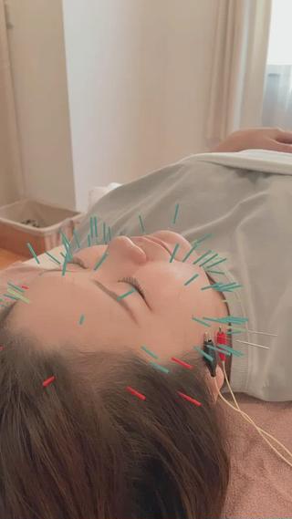 パルス(低周波)で手の届かない筋肉までアプローチ