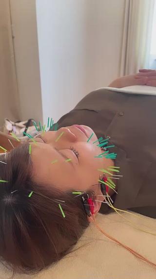 普段使わない筋肉を電気鍼で直接アプローチ️