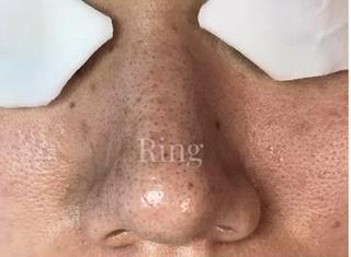 和歌山　毛穴専門店 Ringのエステ・リラクイメージ