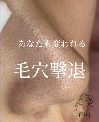 和歌山　毛穴専門店 Ringのエステ・リラクイメージ