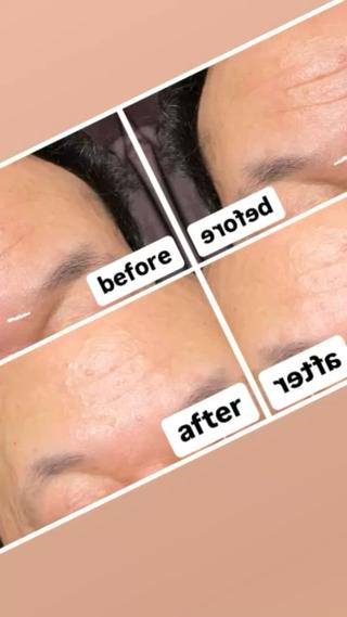 マイクロカレント美容
[お顔の筋肉トレーニング]
お顔のたるみでお悩みの方に。たるんだ表情筋を1つずつ引き締めながら引き上げていきます。施術中に顔筋の引き締まりを感じる方や施術後に顔筋の動きを感じる方(個人差が御座います)

①顔筋のストレッチ(お首にもケア)
②4種類の周波数で衰えた顔筋にアプローチ！
顔筋を1つ1つ引き締めながら引き上げていきます。
③前頭部の引き締め(頭皮からのたるみを引き締めていきます)
⑤お仕上げ
④お耳のマッサージ・ベッドマッサージ

老廃物の排出を促進、シワ、疲れ目もスッキリマイクロカレントならではのふっくら艶々お肌へと導きます。

 