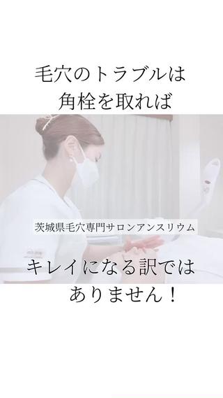 【毛穴の黒ずみ・毛穴の詰まり・開きに悩むあなたへ】

※当サロンのこだわり
施術風景をほんの一部ご紹介♡
 
毛穴に悩む女性のお肌は敏感で弱っています。
 
そのため、
摩擦や刺激の強い施術をしてしまうと
毛穴の悩みを加速させる原因にもなります
 
当サロンの#ミシア式毛穴ケア は

痛みやダウンタイムのある施術はないので
安心して施術を受けていただけます

無理に角栓をとるのではなく
毎回、お客様一人一人の肌状態を確認し、
角栓を取るレベルや
栄養を与える時間を変えていきます。

そしてさらに

一時的なキレイではなく
どうすればリバウンドしない肌になるのか？
スキンケア見直しや毎日の習慣の
アドバイスをしていきます！

2022年も残りわずか…
今から始めれば、2023年の春頃には
毛穴に悩まない日々が待っていますよ

毛穴治療・他エステサロン・自己流ケア
何をしても変わらない毛穴にお悩みの方は

毛穴ケア専門サロン
アンスリウムにご相談ください

- - - - - - - - - - - - - - - - - - - - - - - - - -

【住所】〒300-0016
  茨城県土浦市中神立町12－1ツインパレス24A 

【営業時間】10:00～19:00
　　　　
【定休日】金曜日・不定休

 #ミシアスキン#ミシア式毛穴ケア#毛穴専門サロン#土浦エステ#つくばエステサロン#牛久エステ#龍ケ崎エステ#柏毛穴エステ #毛穴専門サロン茨城#毛穴エステ#毛穴の黒ずみ#毛穴の開き#毛穴のつまり#テカリ#毛穴対策#毛穴ひきしめ#毛穴汚れ#毛穴洗浄#赤ら顔#皮脂#毛穴カバー#ダーマペン#角栓#オイリー肌#酵素洗顔#おでこのテカリ#角栓除去#角栓抜き#角栓ごっそり 