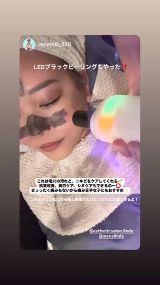 人気インフルエンサーのアメミちゃんもやっています。
LEDブラックピーリング、毛穴の引き締め、美白、ゴワつき改善、シミケアまでできちゃう!
男性の毛穴黒ずみや、お入り肌の肌質改善!
一回で効果を実感できます!